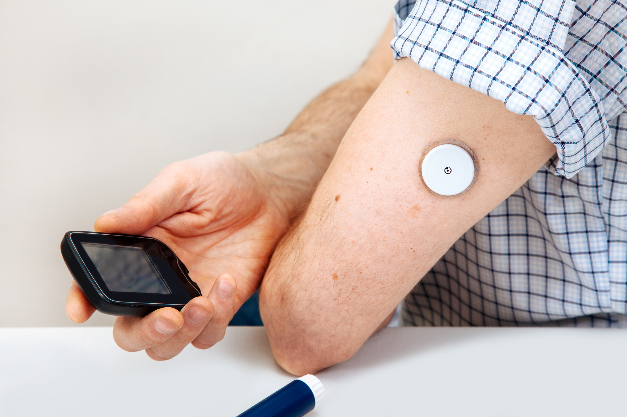 glucosesensor op arm voor diabetes